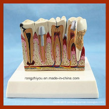 Dental Care Anatomía del Diente Patológico